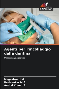 Paperback Agenti per l'incollaggio della dentina [Italian] Book