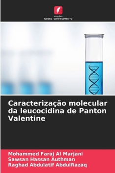 Paperback Caracterização molecular da leucocidina de Panton Valentine [Portuguese] Book