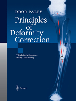 Paperback Principles of Deformity Correction Book
