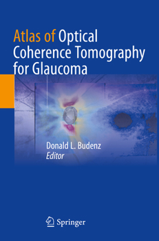 Paperback Atlas of Optical Coherence Tomography for Glaucoma Book