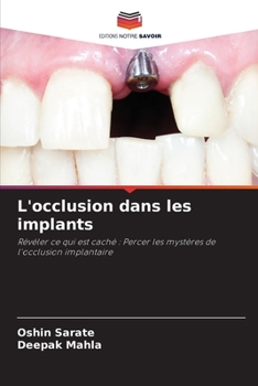 L'occlusion dans les implants: Révéler ce qui est caché : Percer les mystères de l'occlusion implantaire