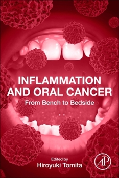 Paperback Inflammation and Oral Cancer: From Bench to Bedside Book