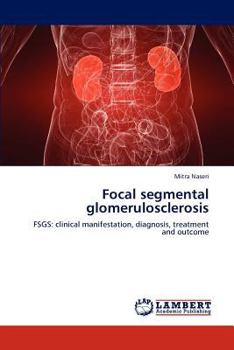 Paperback Focal segmental glomerulosclerosis Book