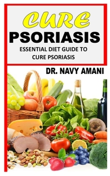 Paperback Cure Psoriasis: Essential Diet Guide To Cure Psoriasis Book