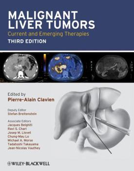 Hardcover Malignant Liver Tumors: Current and Emerging Therapies Book