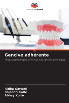 Gencive adhérente (French Edition)