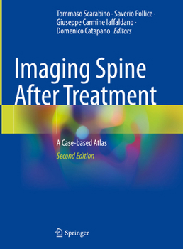 Hardcover Imaging Spine After Treatment: A Case-Based Atlas Book