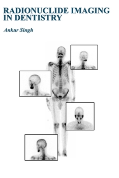 Paperback Radionuclide Imaging in Dentistry Book