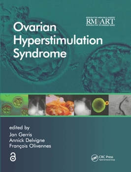 Hardcover Ovarian Hyperstimulation Syndrome Book