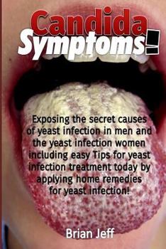 Paperback Candida Symptoms!: Exposing the Secret Causes of Yeast Infection In Men And Women Including the Easy Tips For Yeast Infection Treatment T Book