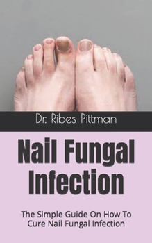 Nail Fungal Infection: The Simple Guide On How To Cure Nail Fungal Infection