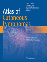 Atlas of Cutaneous Lymphomas: Classification and Differential Diagnosis 3319172166 Book Cover