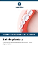 Zahnimplantate: Optimierung der Implantatplatzierung mit Sinus-Augmentation 6206001512 Book Cover