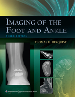 Radiology of the Foot and Ankle 0781720095 Book Cover