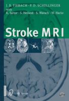 Stroke MRI 3798513724 Book Cover