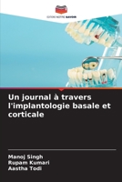 Un journal à travers l'implantologie basale et corticale 6204126644 Book Cover