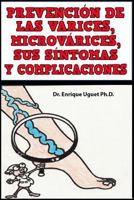 Prevencion de Las Varices, Microvarices, Sus Sintomas y Complicaciones: 1546398678 Book Cover