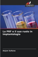 La PRF e il suo ruolo in implantologia 620584284X Book Cover