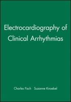 Electrocardiography of Clinical Arrhythmias 0879934468 Book Cover