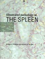 Illustrated Pathology of the Spleen 0521622271 Book Cover