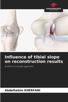 Influence of tibial slope on reconstruction results 6209402348 Book Cover
