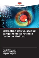 Extraction des vaisseaux sanguins de la rétine à l'aide de MATLab 620561331X Book Cover