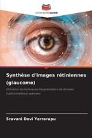 Synthèse d'images rétiniennes (glaucome): Utilisation de techniques d'augmentation de données traditionnelles et avancées 6206301273 Book Cover