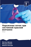 Поражение почек при сист 6204433997 Book Cover