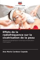 Effets de la radiofréquence sur la cicatrisation de la peau: Analyse planigraphique numérique et évaluation histologique (French Edition) 6207667972 Book Cover