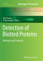 Detection of Blotted Proteins: Methods and Protocols 1493927175 Book Cover