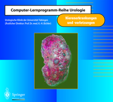 Nierenerkrankungen und -verletzungen (Computer-Lernprogramm-Reihe Urologie) 3540147462 Book Cover