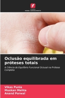 Oclusão equilibrada em próteses totais (Portuguese Edition) 6630085973 Book Cover