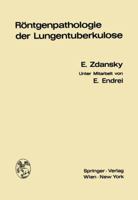 Rontgenpathologie Der Lungentuberkulose 3709151031 Book Cover