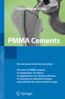PMMA Cements 3642415350 Book Cover