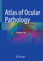 Atlas of Ocular Pathology 9819535247 Book Cover