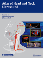 Atlas of Head and Neck Ultrasound 3131603518 Book Cover