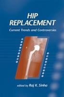 Hip Replacement: Current Trends And Controversies B000Q025U2 Book Cover