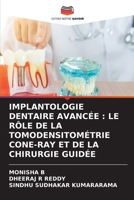 Implantologie Dentaire Avancée: Le Rôle de la Tomodensitométrie Cone-Ray Et de la Chirurgie Guidée (French Edition) 6630208269 Book Cover