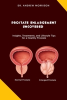 Prostrate Enlargement Uncovered: Insights, Treatments, and Lifestyle Tips for a Healthy Prostate B0C9SGWXJG Book Cover