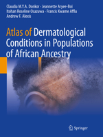 Atlas of Dermatological Conditions in Populations of African Ancestry 3030726193 Book Cover