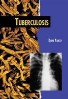Tuberculosis (Twenty-First Century Medical Library) 0822591901 Book Cover