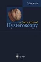 A Color Atlas of Hysteroscopy 443170244X Book Cover
