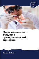 Мини-имплантат - будущее ортодонтической фиксации 6206011933 Book Cover
