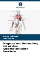 Diagnose und Behandlung der akuten lymphoblastischen Leukämie (German Edition) 6208184894 Book Cover