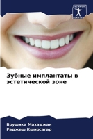 Зубные имплантаты в эсте 6207259688 Book Cover
