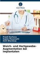 Weich- und Hartgewebe-Augmentation bei Implantaten 6203232041 Book Cover