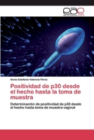 Positividad de p30 desde el hecho hasta la toma de muestra 6200397295 Book Cover