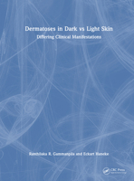 Dermatoses in Dark Vs Light Skin: Differing Clinical Manifestations 1032766638 Book Cover