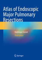 Atlas of Endoscopic Major Pulmonary Resections 3030741141 Book Cover