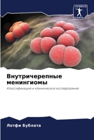 Внутричерепные менингиомы: Классификация и клиническое исследование 6206050912 Book Cover